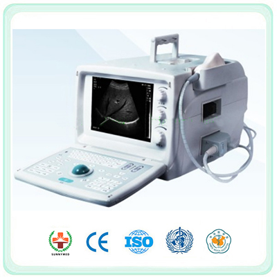 SU635 Full Digital Ultrasound Scanner